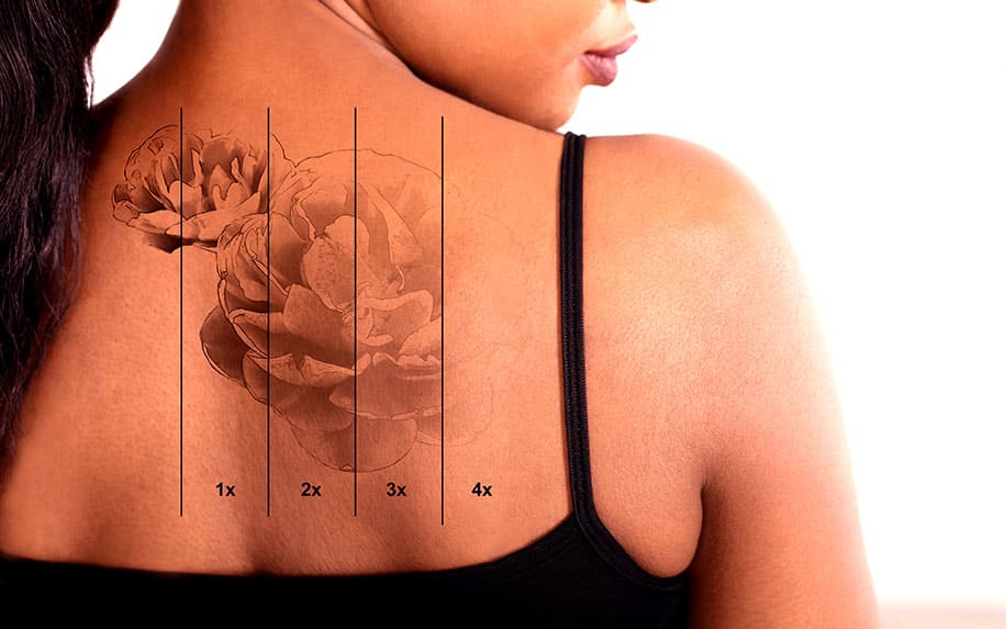 Does CBD help in making tattoos with less pain?